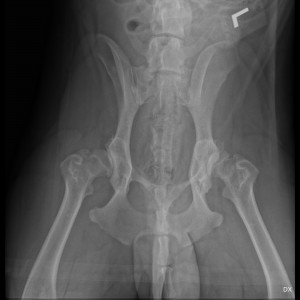 X-ray of severe hip dysplasia